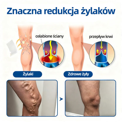 🇵🇱 Healrize® VeinTarget Plaster z mikroigłami |⚡ Natychmiastowa ulga, długotrwałe efekty