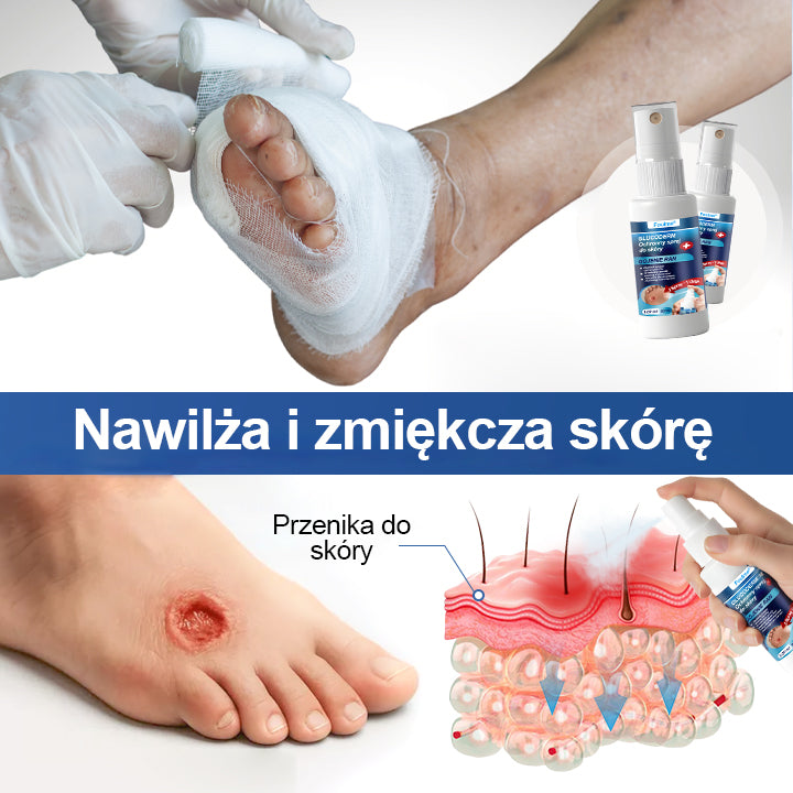🎄 FOULME® GlucoDerm – Spray ochronny | Świąteczna edycja ✨