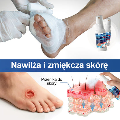 🎄 FOULME® GlucoDerm – Spray ochronny | Świąteczna edycja ✨