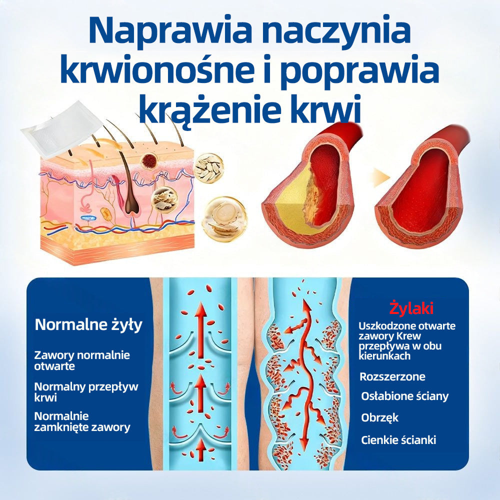 🇵🇱 Healrize® VeinTarget Plaster z mikroigłami |⚡ Natychmiastowa ulga, długotrwałe efekty